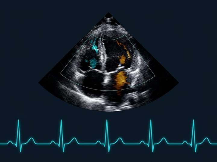 Clinical illustration for Cardiology with 4-chamber Doppler echocardiogram and ECG trace