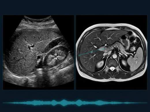 Clinical illustration for Gastroenterology and abdominal imaging with ultrasound and MRI