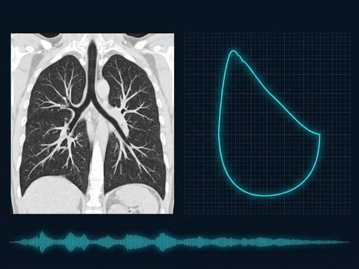 Clinical illustration for Pulmonology with coronal chest CT reconstruction and spirometry curve