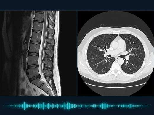 Clinical illustration for Radiology and Imaging with spine MRI, chest CT, and voice waveform
